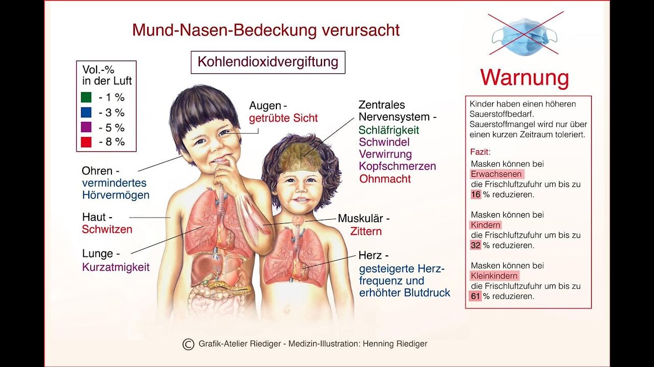 SCA 30 Unter der Lupe