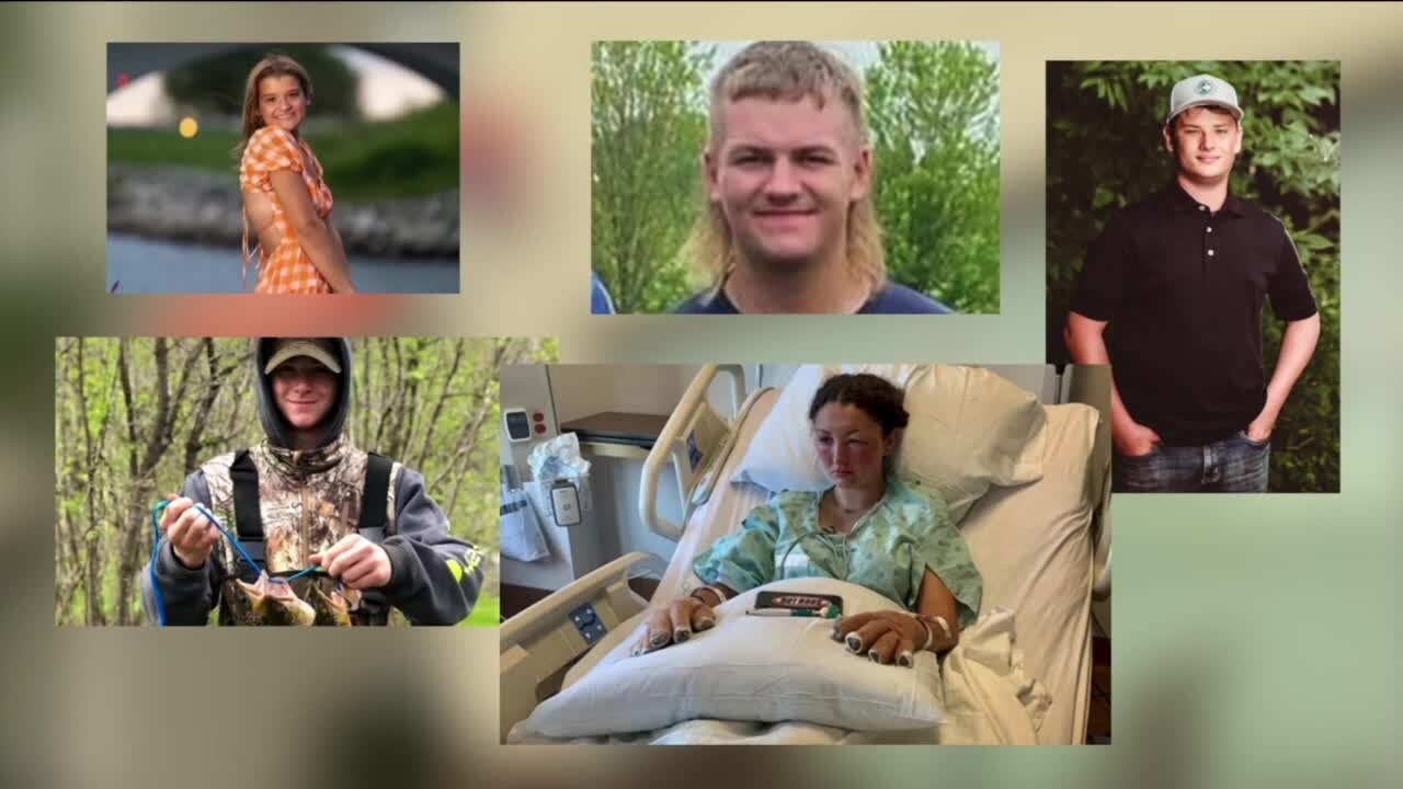 Five victims remain in Milwaukee burn center after Pulaski homecoming bonfire explosion