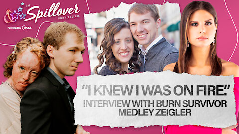 "I Knew I Was On Fire." – Interview with Burn Survivor Medley Zeigler