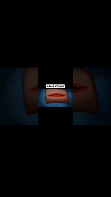 || Wisdom Tooth Extraction|| Hip Replacment||