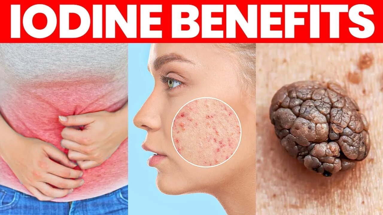 The Benefits of Iodine, Side-Effects and More