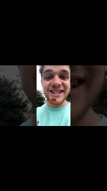 DOG ATTACKS MAN IRL reaction