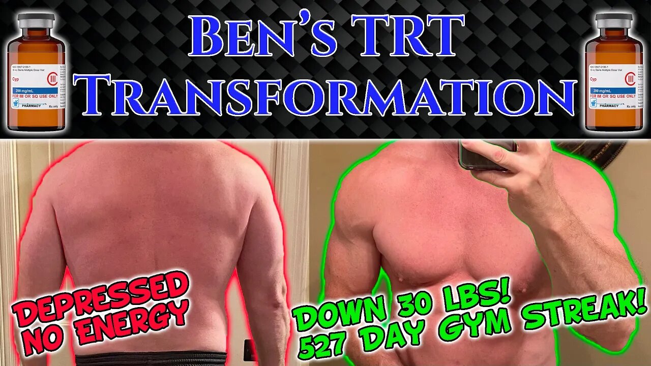 Bens Awesome TRT Transformation! Testosterone Replacement Therapy Turned Ben in a TRT Beast!!!