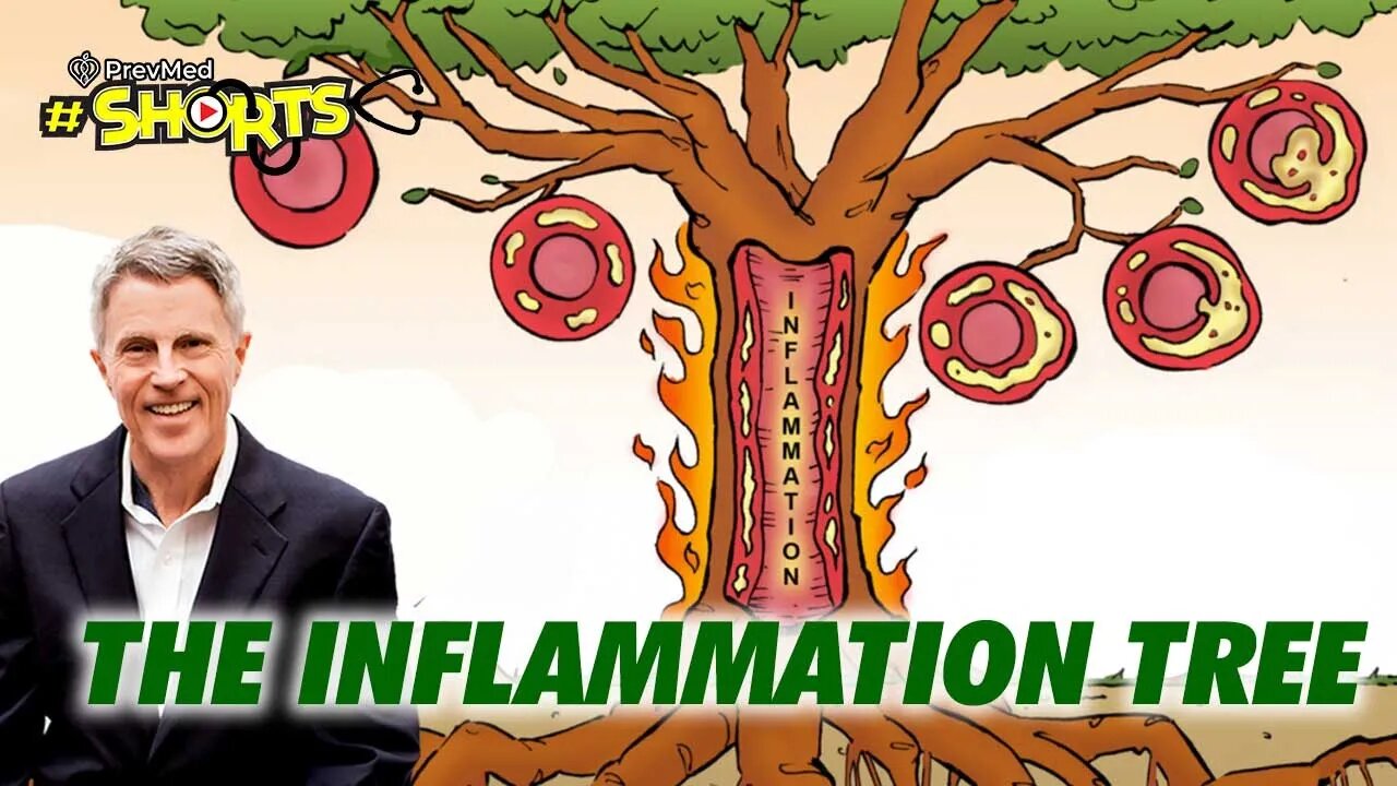 #SHORTS The Inflammation Tree