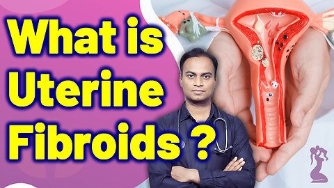 What is Utetine Fibroids? | Treatment Cure Medicine Surgery Gynaecology Women Female | Dr. Bharadwaz