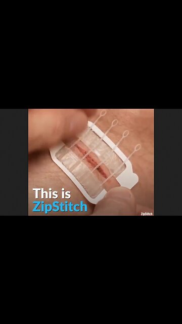 BECAUSE STITCHING WOUNDS IS NOW SO YESTERDAY - HaloRockNews