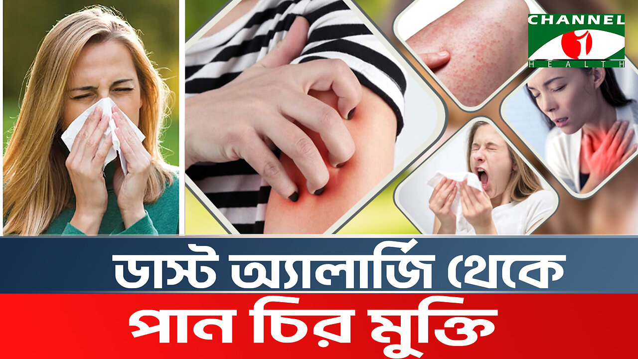 ডাস্ট অ্যালার্জি কেন হয়? ডাস্ট অ্যালার্জি থেকে মুক্তির সমাধান | Dust Allergy Symptoms & Treatment