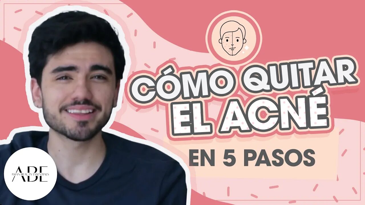 COMO QUITAR EL ACNE EN 5 PASOS