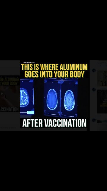 THIS IS WHERE ALUMINUM GOES INTO YOUR BODY AFTER VACCINATION