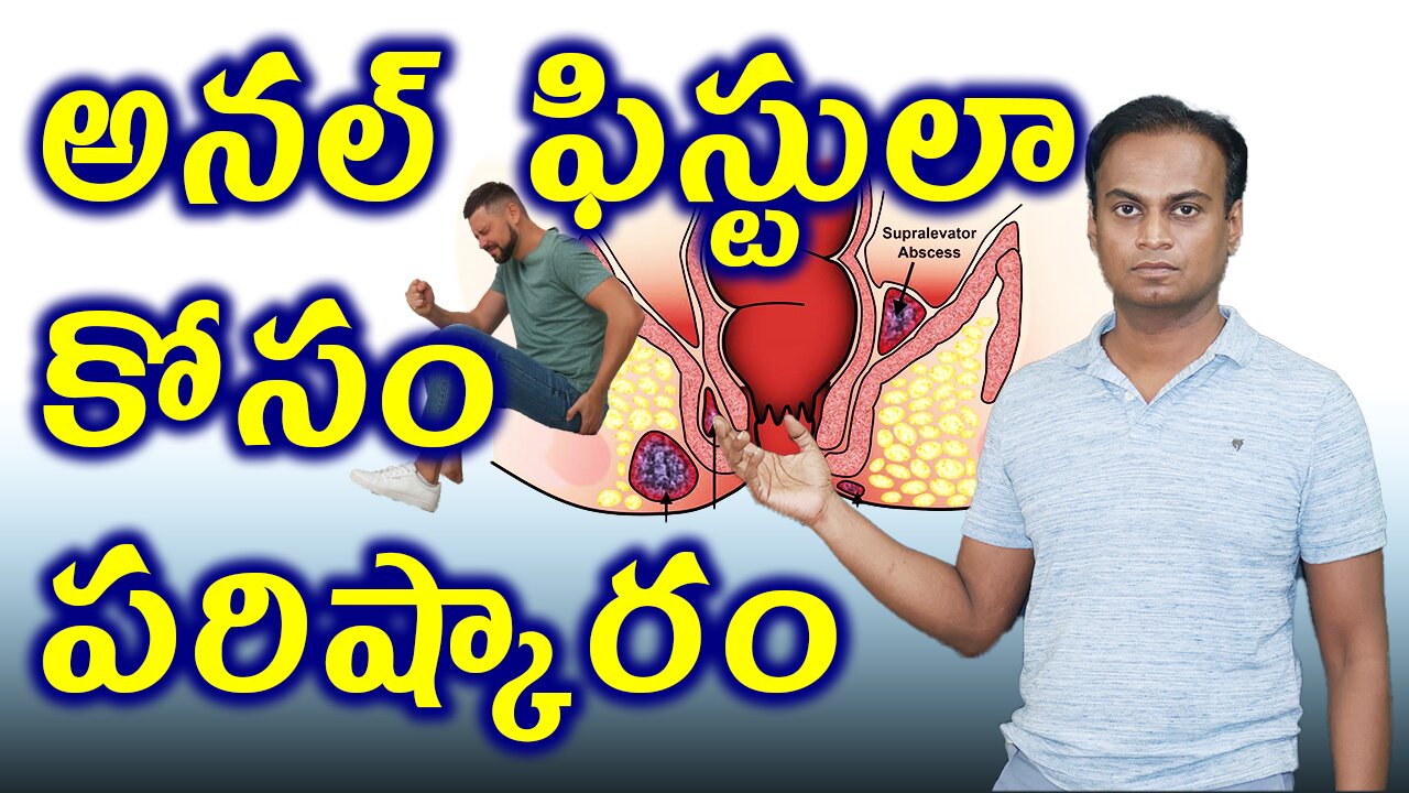 అనల్ ఫిస్టులా కోసం పరిష్కారం , Anal Fistula Treatment Cure . English | డా. భరద్వాజ్ | హోమియోపతి