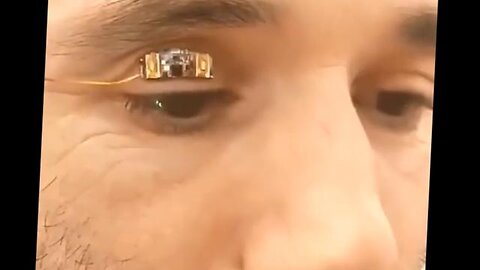 TECHNOLOGY IS ADVANCING - Smart Ocular Devices Internet of Bodies