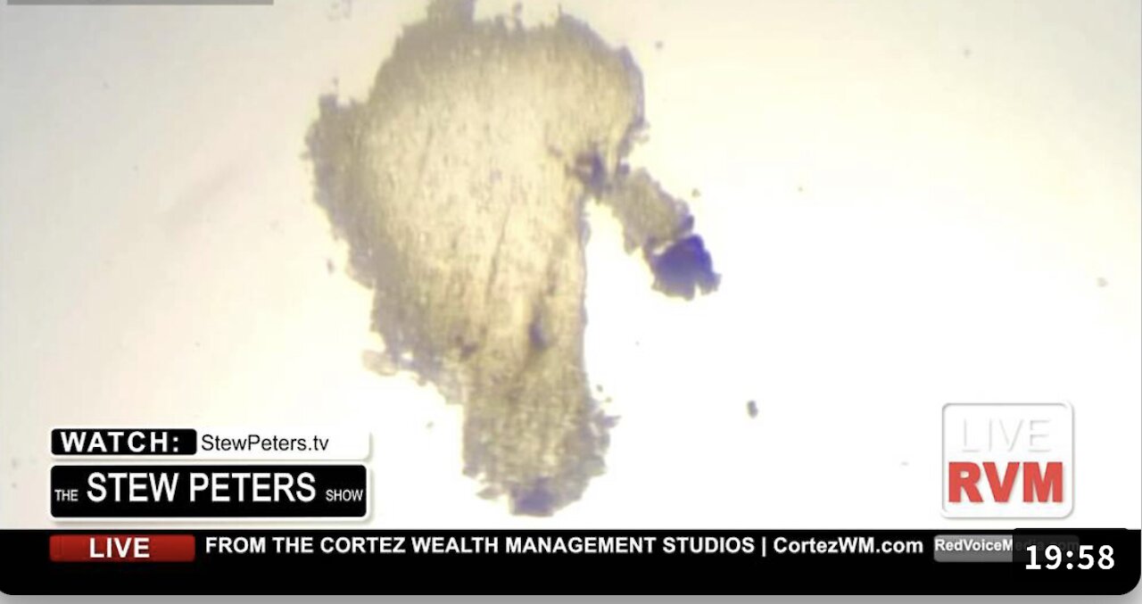 Dr. Shows Horrifying Images Of Magnified COVID VACCINE!!