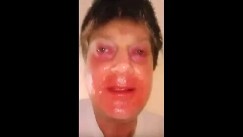 The negative EX be hitting differently