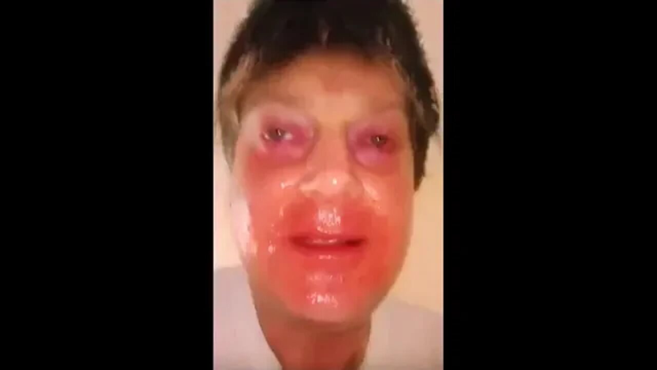 The negative EX be hitting differently