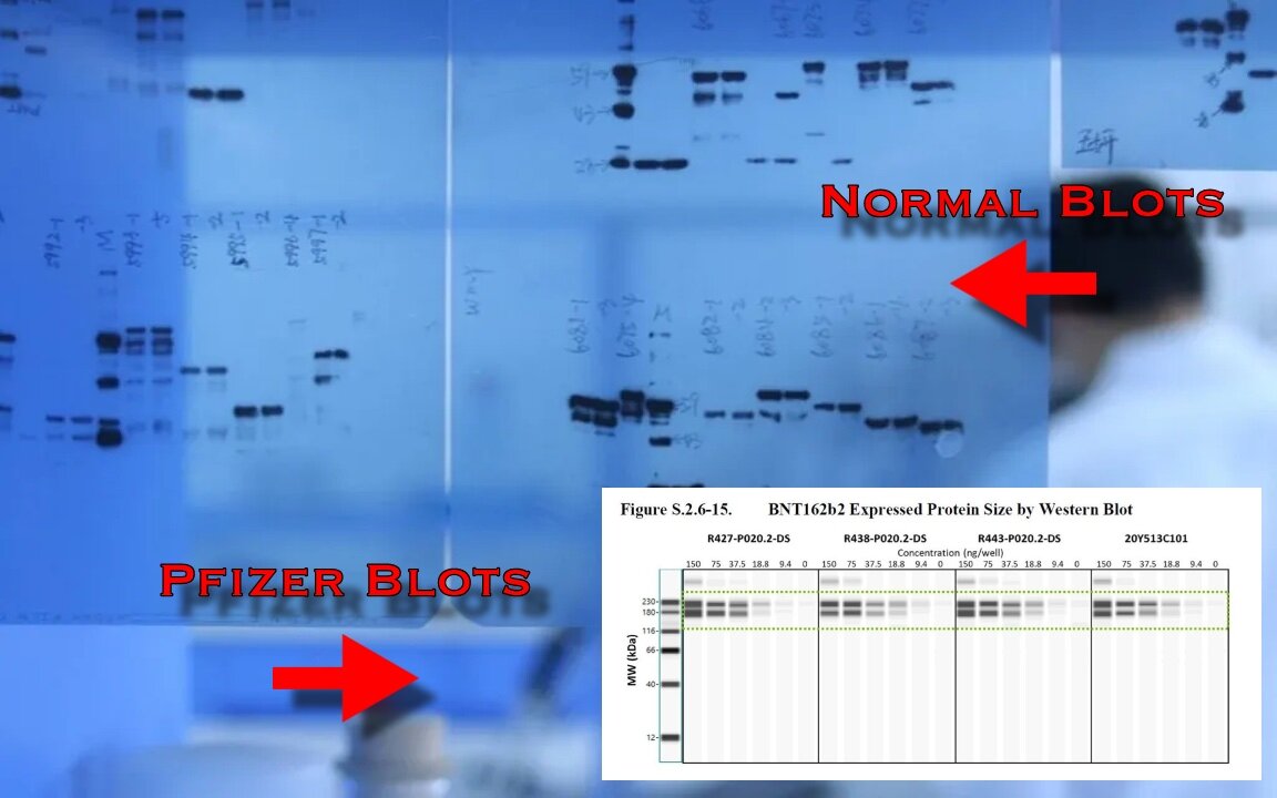 Jessica Rose PhD Interview - #Blotgate & The Unknown Risks Of "Truncated Spike Protein"