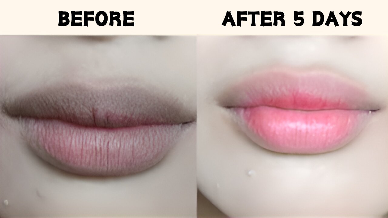 How to get pink lips | lighten dark lips | Causes and treatment of dark lips