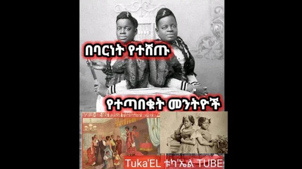 የተጣበቁት መንትዮች አሳዛኝና አስገራሚ #የባርነት ሕይወት።