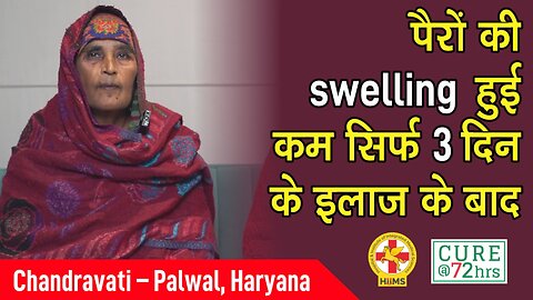 पैरों की swelling हुई कम सिर्फ 3 दिन के इलाज के बाद