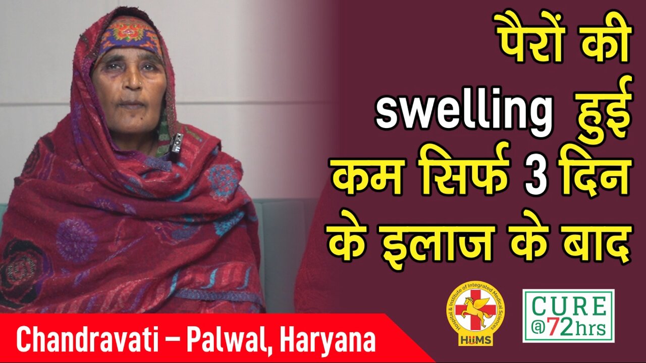 पैरों की swelling हुई कम सिर्फ 3 दिन के इलाज के बाद