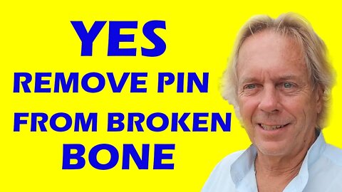 No Doubt, Best to Remove Pins From Broken Bones