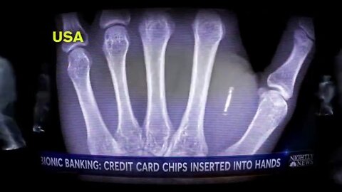Facial Recognition and a Chip. IT'S WHAT'S NEXT.