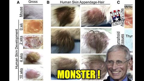 Dr. Fauci is Funding Gruesome Study Skinning Scalps off of Aborted Babies and Growing Them on Rats !