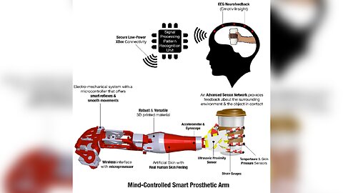 Robotic Limbs Controlled By Brain