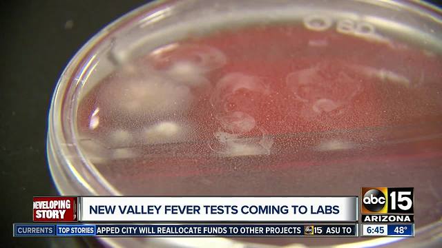 New Valley Fever tests coming to labs