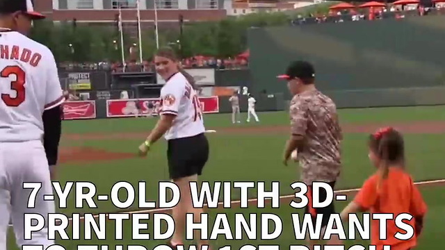 7-Yr-Old With 3D-printed Hand Wants To Throw 1st Pitch For Every MLB Team