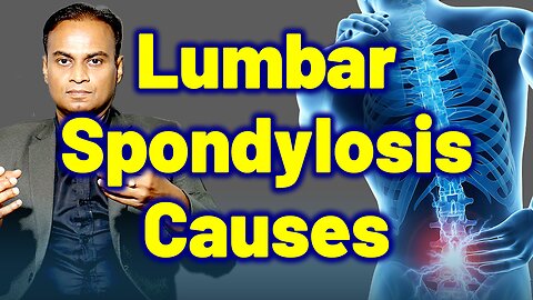 Risk Factors and Causes for Lumbar Spondylosis | Low Back Pain Causes | Homeopathy Treatment & Cure