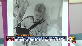 Solving sleep apnea in Down syndrome kids