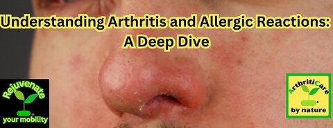 Understanding Arthritis and Allergic Reactions: A Deep Dive - ArthritiCare