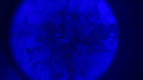 These parasites seem to illuminate under a blacklight