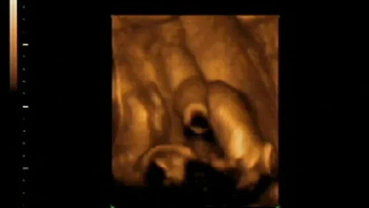 Aidan Xavier Lucchese 4D Scan 061205