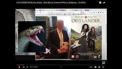 OUTLANDER Bit By Snake, Blue Blood, Artemis Willows, Baldness, It's REAL! [14.04.2022]