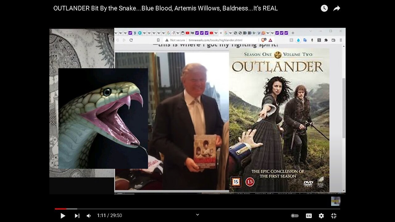 OUTLANDER Bit By Snake, Blue Blood, Artemis Willows, Baldness, It's REAL! [14.04.2022]