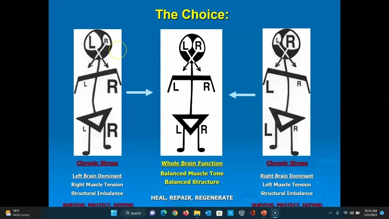 Cranial Release technique (CRT) - The CRT Choice