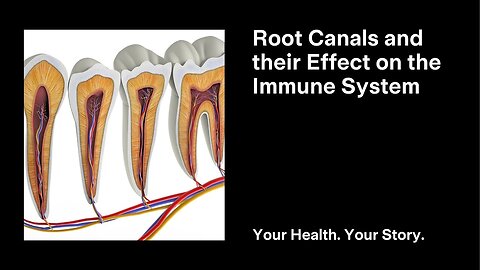 Root Canals and their Effect on the Immune System