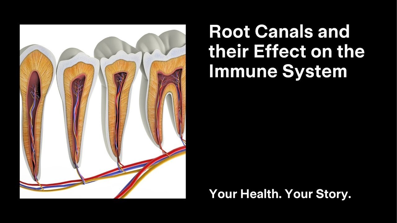 Root Canals and their Effect on the Immune System