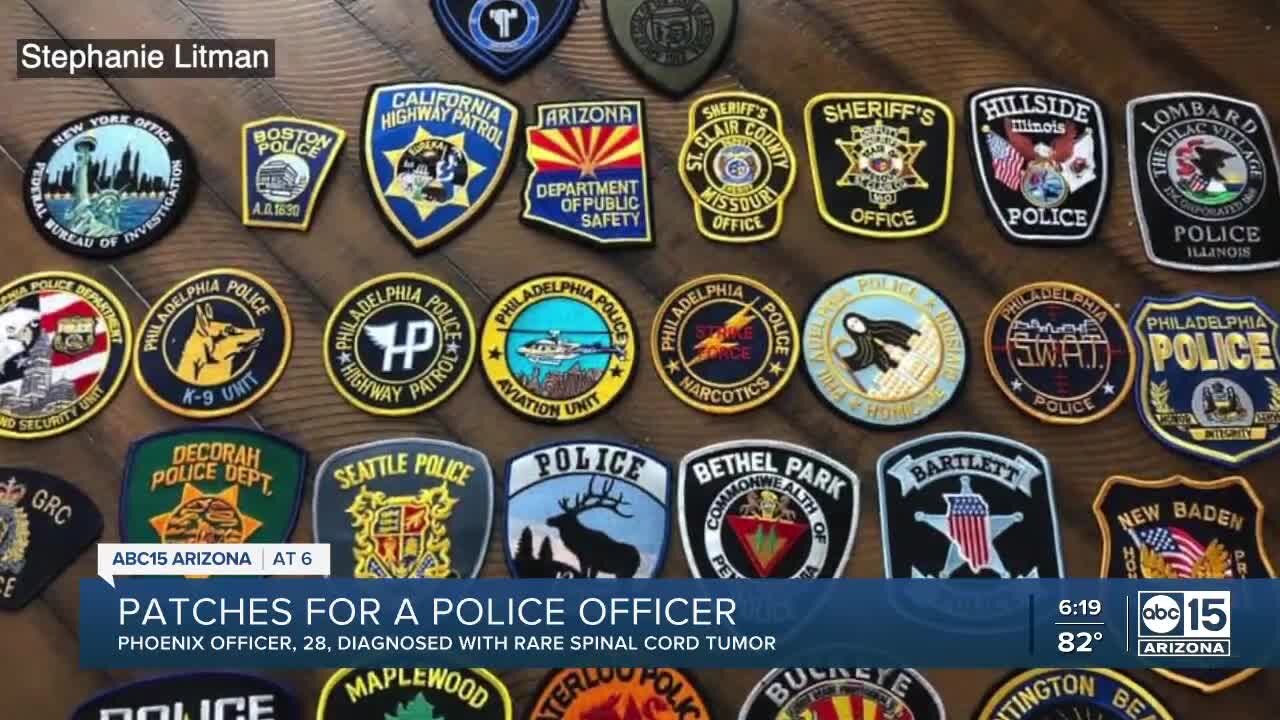 Family seeks patches for Phoenix police officer battling rare condition