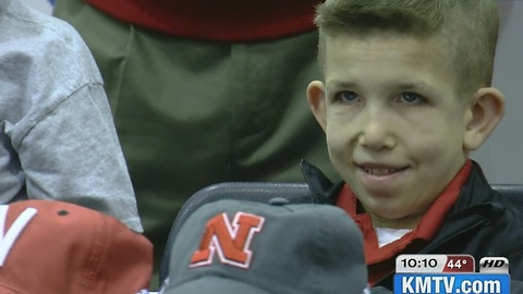 Huskers to honor boy battling terminal illness