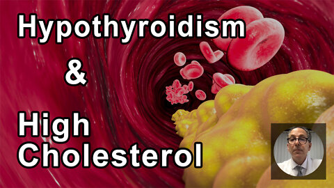 Is There A Connection Between Hypothyroidism And High Cholesterol? - Joel Kahn, MD