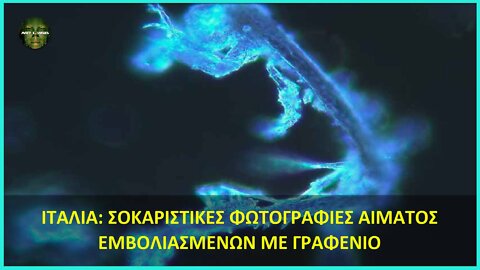 ΙΤΑΛΙΑ: ΣΟΚΑΡΙΣΤΙΚΕΣ ΦΩΤΟΓΡΑΦΙΕΣ ΑΙΜΑΤΟΣ ΕΜΒΟΛΙΑΣΜΕΝΩΝ ΜΕ ΓΡΑΦΕΝΙΟ