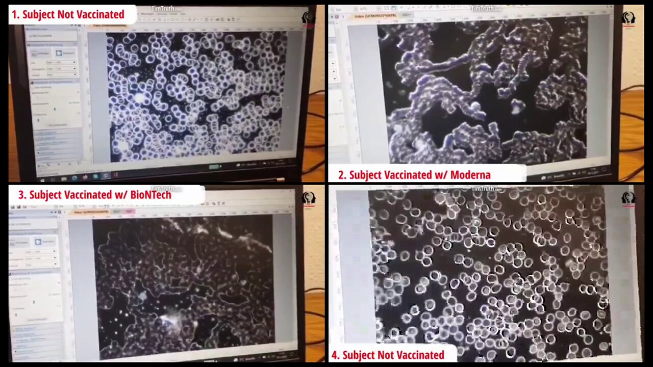 Vaccinated (with Covid 19 Vaccines) vs Unvaccinated Blood under the microscope..