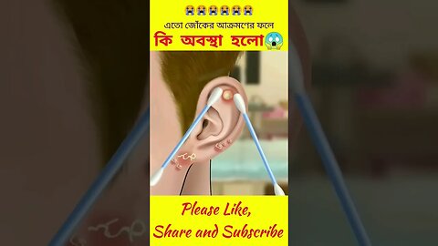 এতো জোকের আক্রমণে এ কি হলো😱😱 #shorts #youtubeshorts #viral vocalcandy