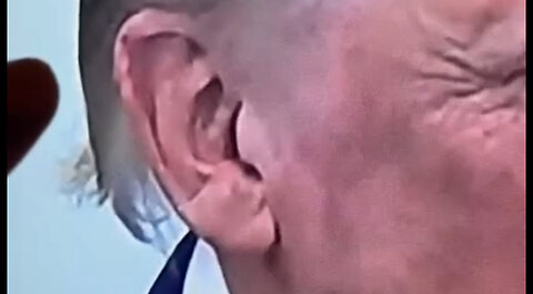 Trump’s Scar