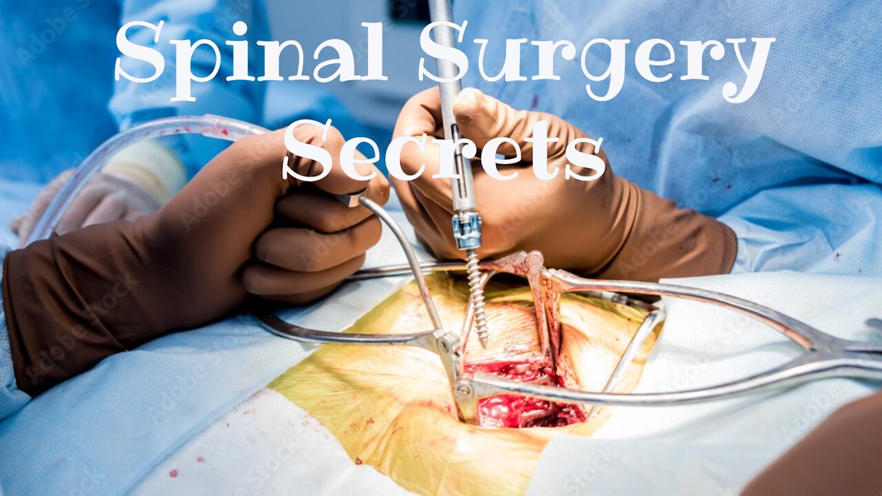 What Spinal Surgeons DON'T want you to know