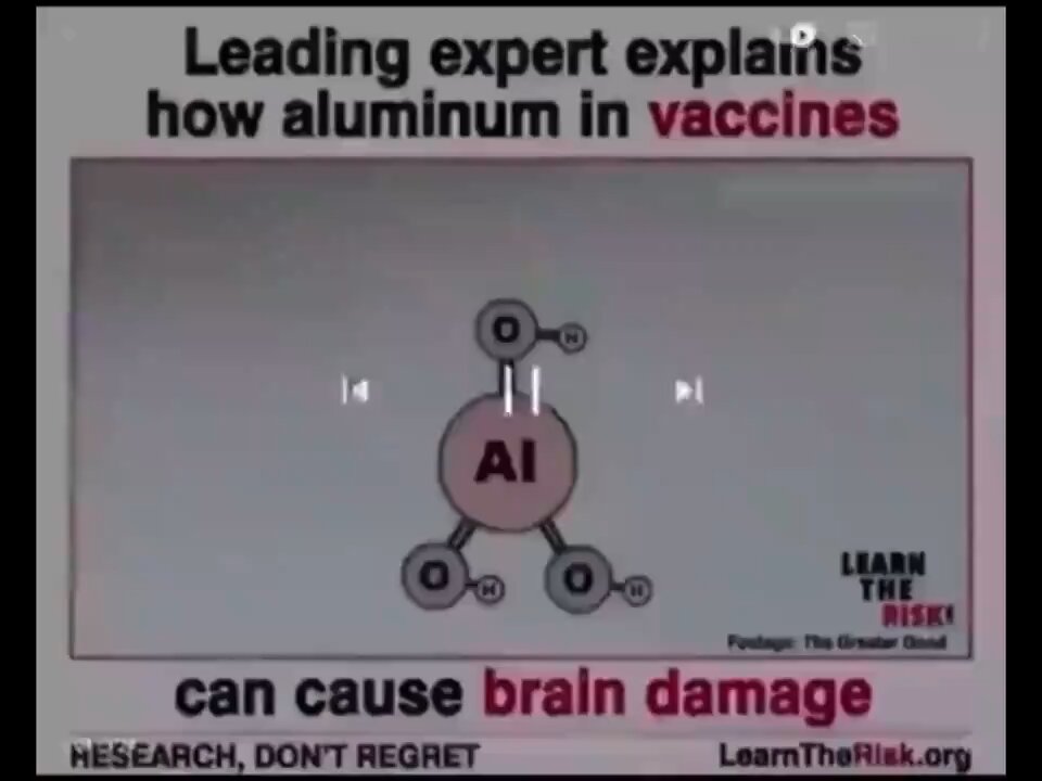 aluminum in vaccine can cause brain damage.