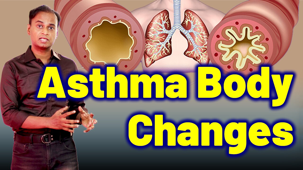 Changes in the body due to Asthma - Homeopathy Treatment & Cure | Dr. Bharadwaz | Homeopathy