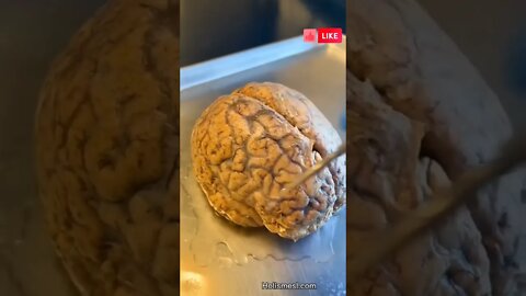 Create New Brain Connections by Doing This